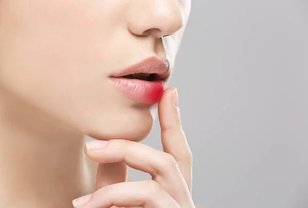 Женские губы с вирусом герпеса — стоковое фото