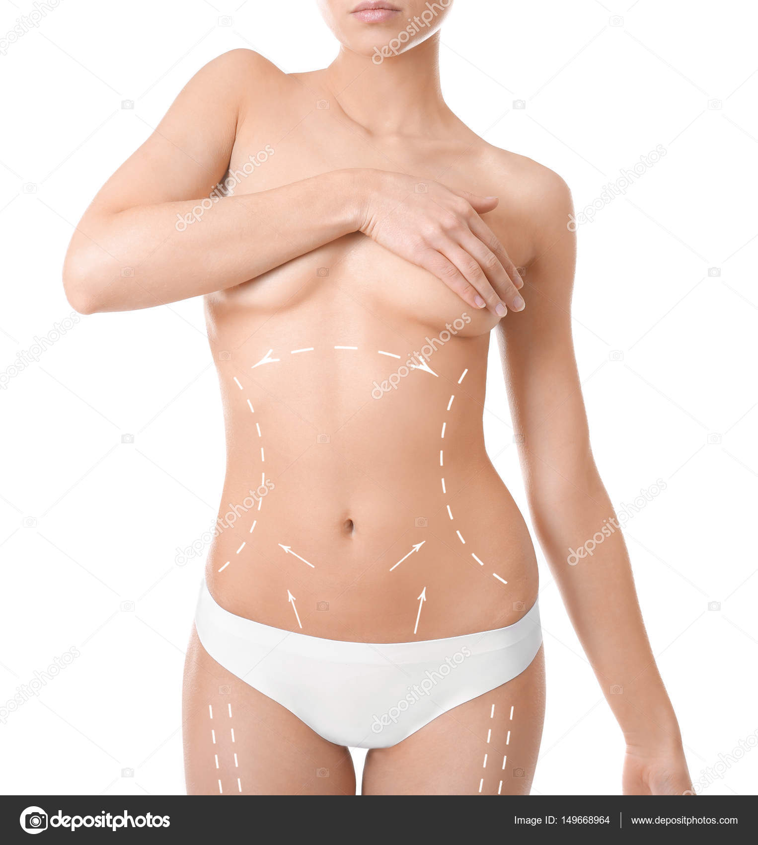 Plastic surgery concept. Female body with marks on white background Stock  Photo by ©belchonock 149668964