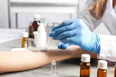 Doktor yapma alerji testi 