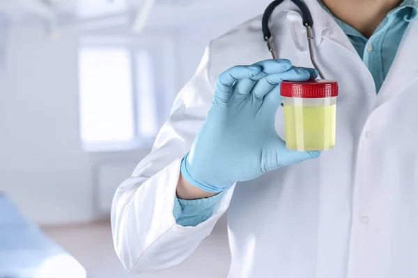 Doctor holding jar with urine — Stock Photo, Image
