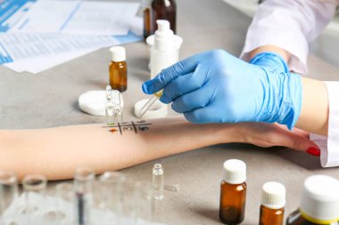 Doktor yapma alerji testi 