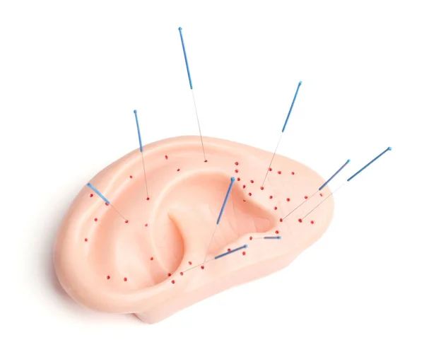 Acupunctuur oor en benodigdheden — Stockfoto