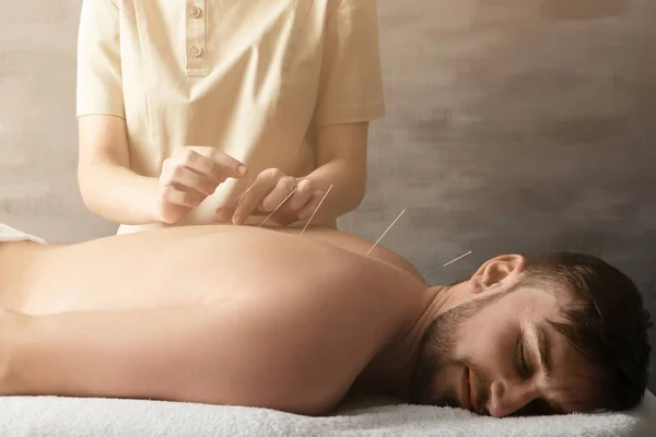 Young man getting acupuncture treatment