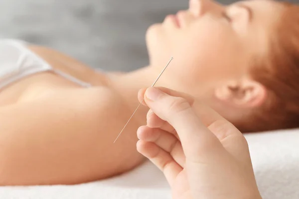 Terapia corporal femenina. Aguja de sujeción acupunturista, primer plano —  Fotos de Stock