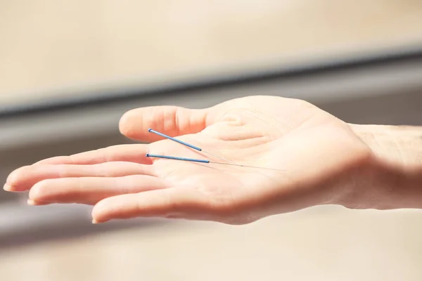 Frauenhand mit Nadeln für Akupunktur — Stockfoto