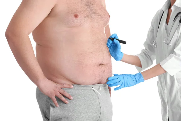 Doctor applying marks on belly of man — Stock Photo, Image