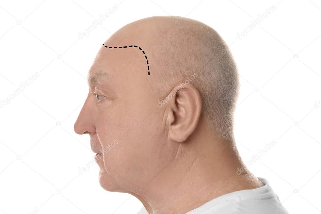 Bald senior man