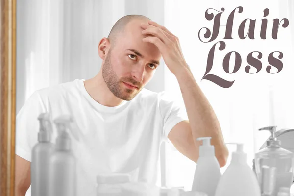 Concepto de pérdida de cabello. Hombre mirando el espejo —  Fotos de Stock