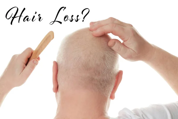 Έννοια απώλεια μαλλιών. Ανώτερος άνθρωπος με χτένα σε λευκό φόντο — Φωτογραφία Αρχείου