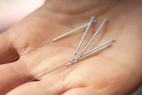 Mano femenina con agujas para acupuntura — Foto de Stock