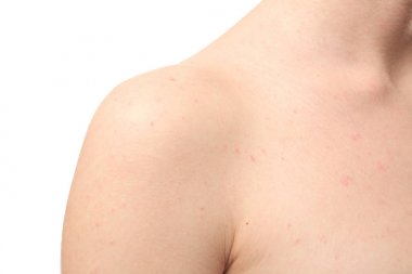 cilt sorunu olan kadın