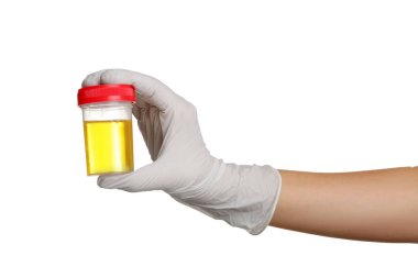 Hand holding  urine test  clipart
