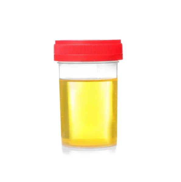 Test delle urine mediche — Foto Stock