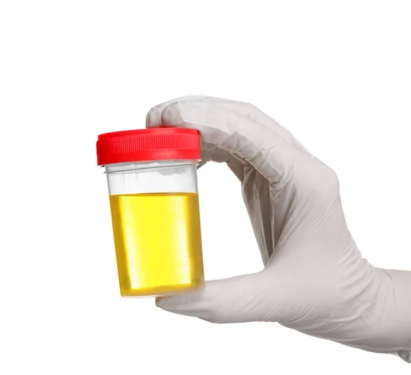 Teste de urina à mão — Fotografia de Stock