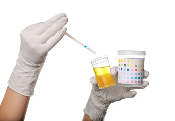 Reagent strip test for urinalysis — Stock Photo, Image