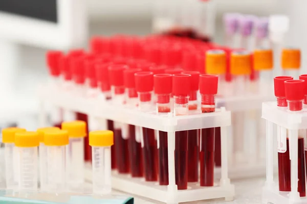 Tubos de ensaio com sangue na mesa em laboratório — Fotografia de Stock