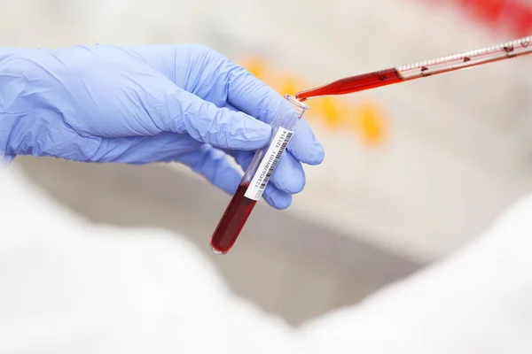 Vědec, který pracuje s krevním vzorkem — Stock fotografie