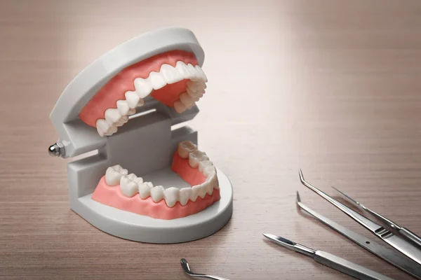 歯科用顎模型 — ストック写真