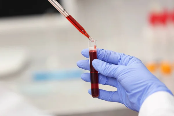Científico trabajando con muestra de sangre — Foto de Stock