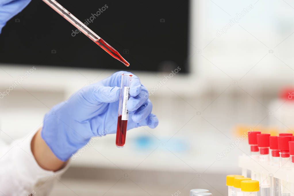 Scientist working with blood sample 