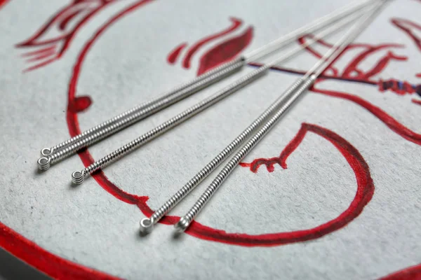 Agulhas de acupuntura na embalagem, close-up — Fotografia de Stock