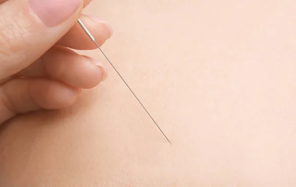 Woman stimulating acupuncture points — Stock Photo, Image