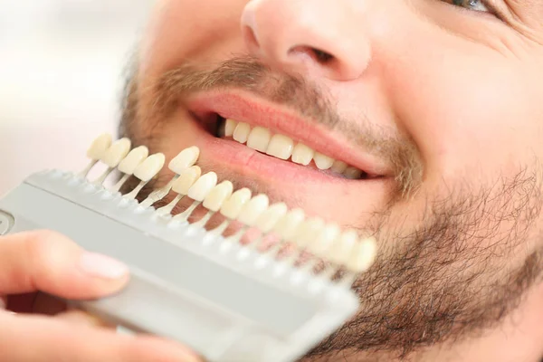 Dentysta, sprawdzanie i wybierając kolor zębów młodego człowieka, zbliżenie — Zdjęcie stockowe