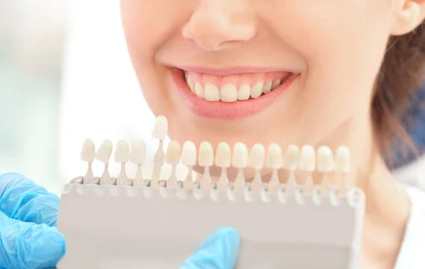 Dentist checking and selecting color of young woman's teeth — Stock Photo, Image