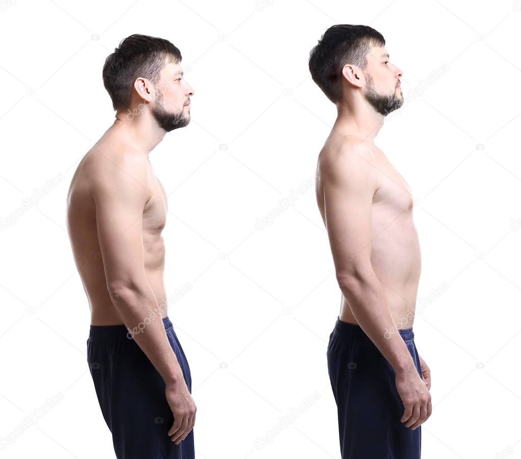 Rehabilitation concept. Collage of man with poor and good posture on white background