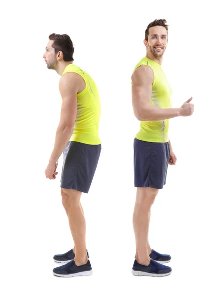 Concetto di riabilitazione. Collage di uomo con postura povera e buona su sfondo bianco — Foto Stock