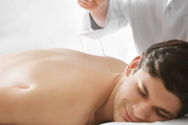 Człowiek przechodzi leczenie akupunktura — Zdjęcie stockowe