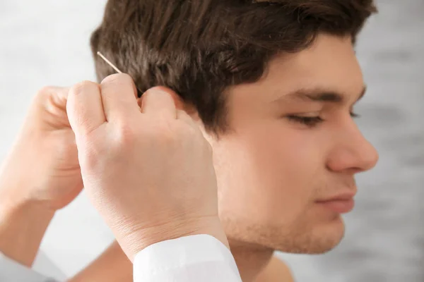 Homme subissant un traitement d'acupuncture — Photo