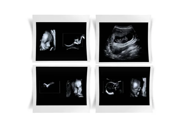 Gambar Ultrasound bayi — Stok Foto