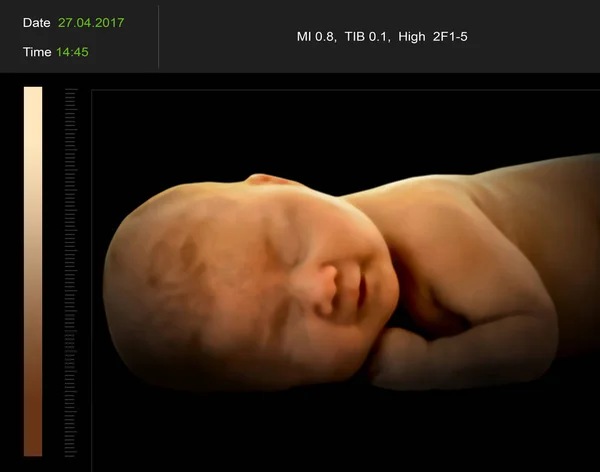 Ultra-som 3D do bebê — Fotografia de Stock