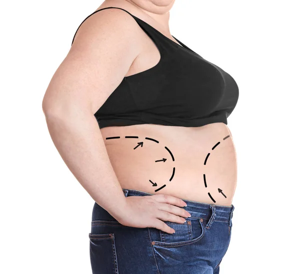 Mulher com problema de gordura marcado — Fotografia de Stock