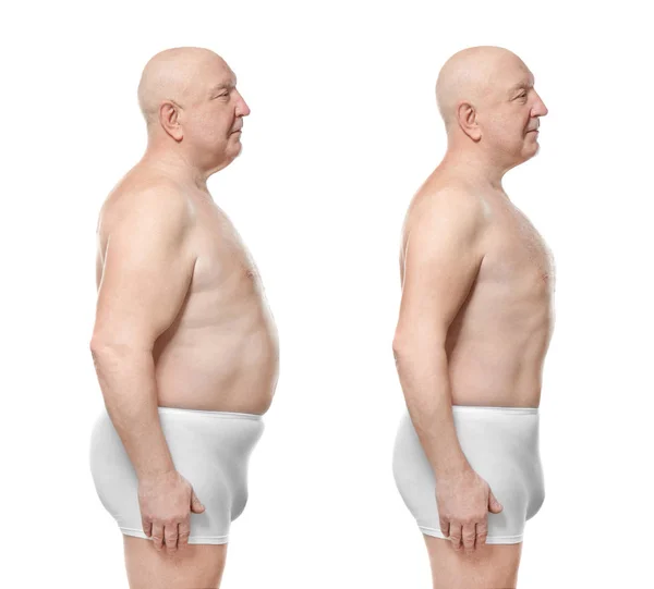 Man before and after weight loss — Stock Photo, Image