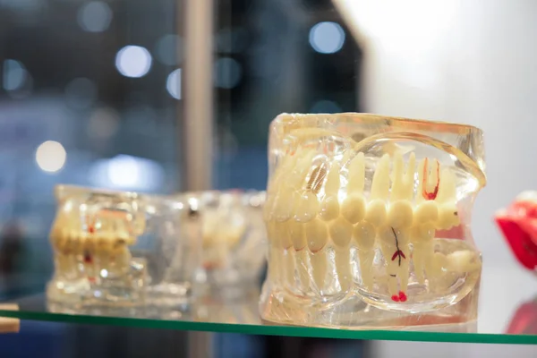Modello mascella dentale su ripiano in vetro — Foto Stock