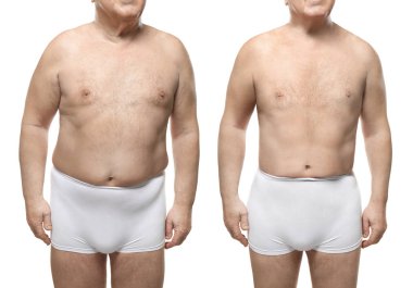 Adam önce ve sonra kilo kaybı 