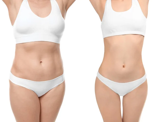 Kvinna före och efter viktminskning — Stockfoto