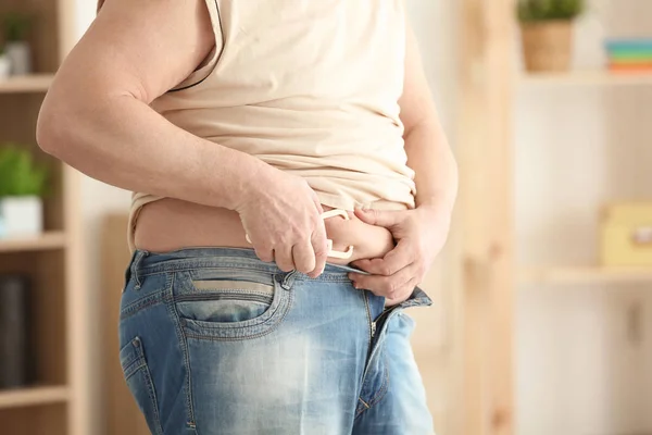 Hombre gordo con pinza de medición —  Fotos de Stock