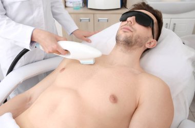 man getting laser epilation