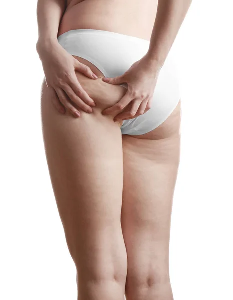 Femme avec de la cellulite sur les fesses — Photo