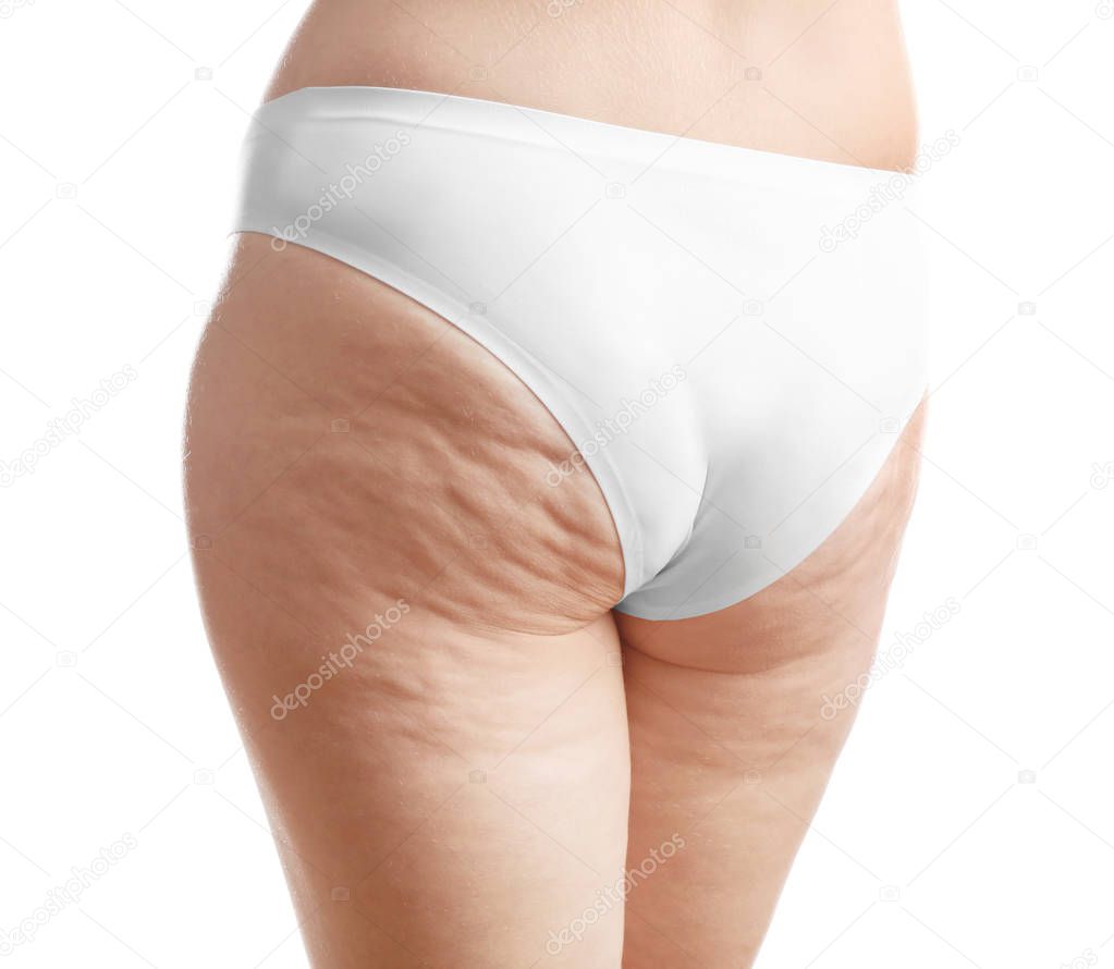 Cellulite Po Cellulite Po