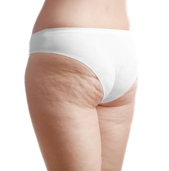 Woman with cellulite on buttocks — Stock Photo, Image