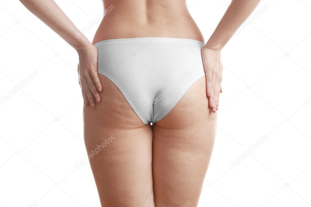 Woman with cellulite on buttocks 