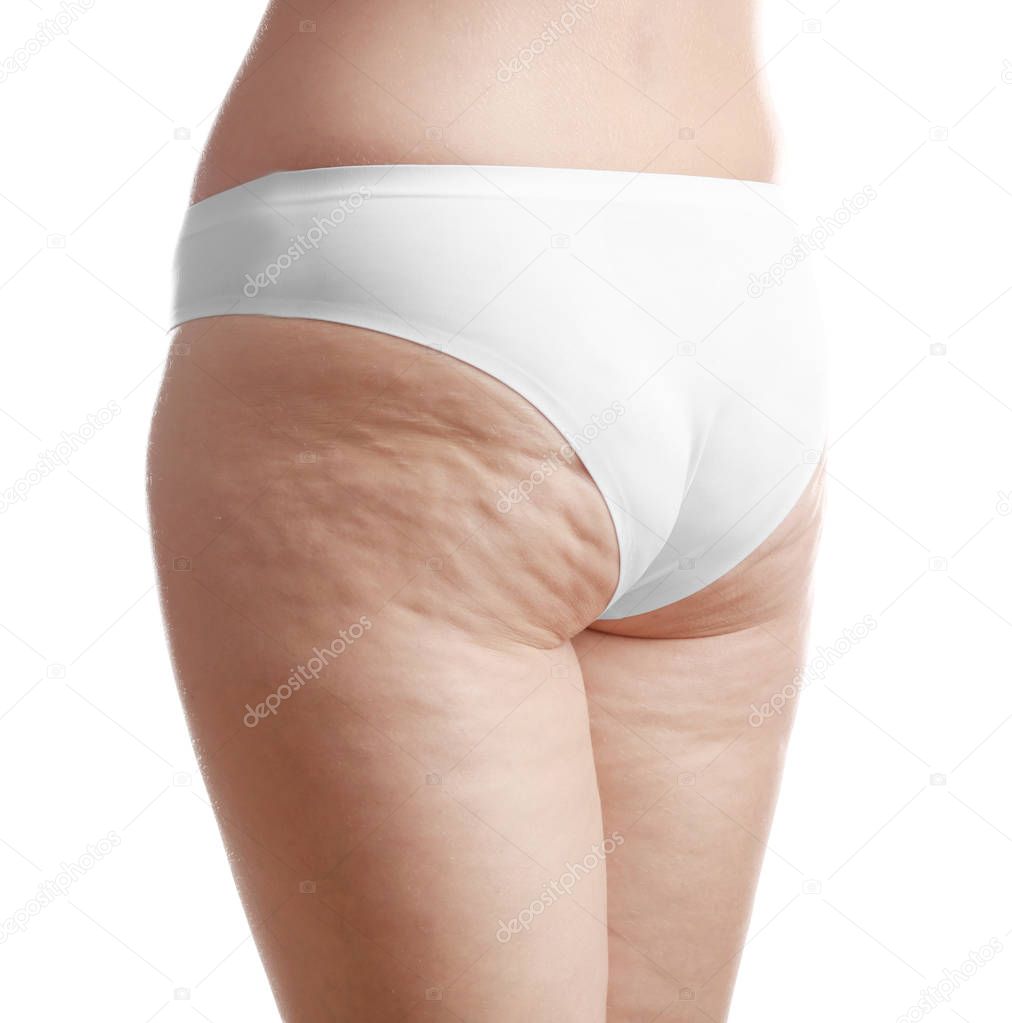 Woman with cellulite on buttocks  