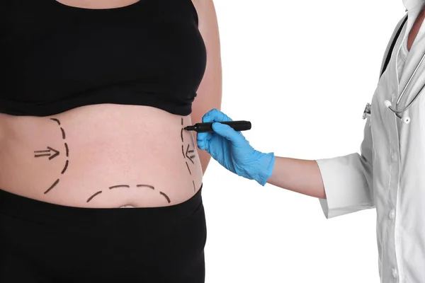 Doctor marking stout woman's belly t — Stock Photo, Image