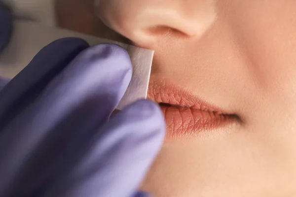 Woman undergoing epilation procedure — Stock Photo, Image