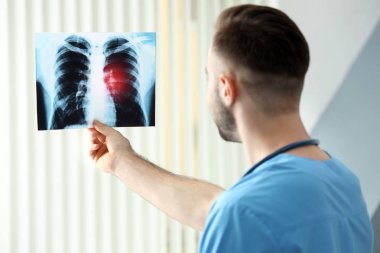 Doktor hastanede röntgen görüntüsüyle. Akciğer kanser kavramı