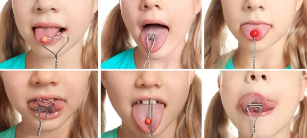 Collage de niña usando herramientas especiales, primer plano. Concepto de terapia del habla — Foto de Stock